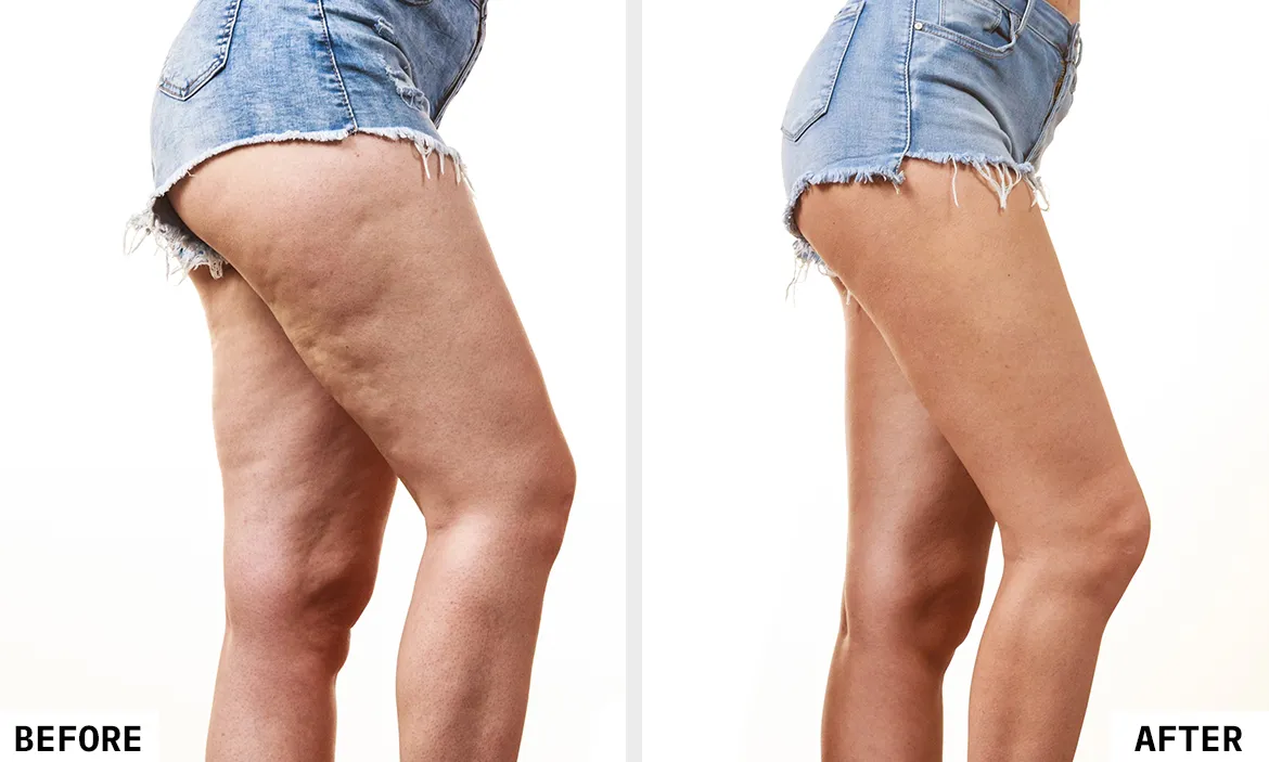 Before and After Results 1