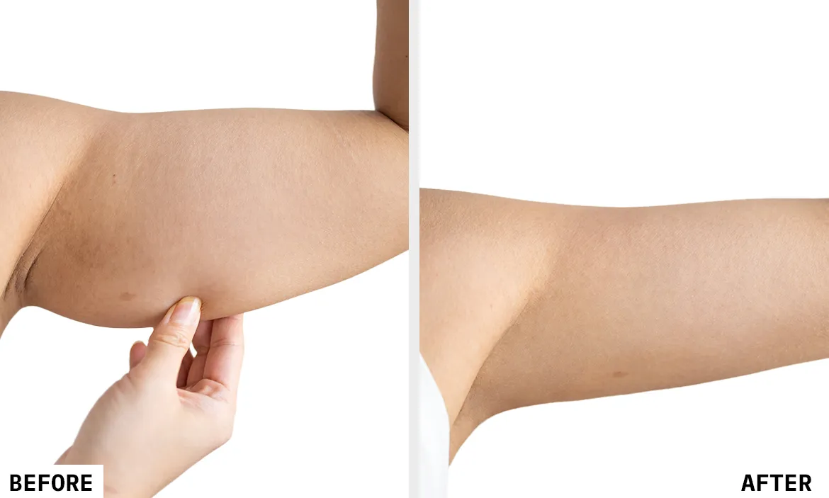 Before and After Results 3