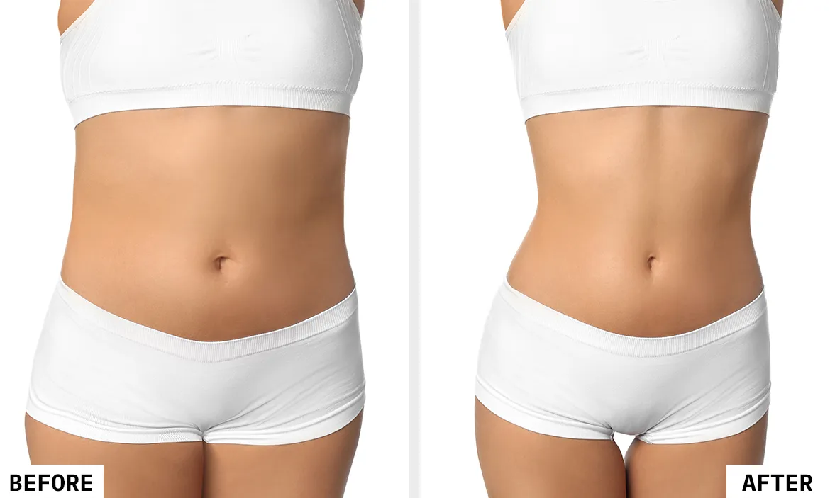 Before and After Results 6